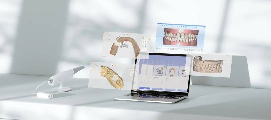 國內首家齒科數字化CAD/CAM軟硬件研發企業落戶拱墅，推動計算機系統集成創新發展